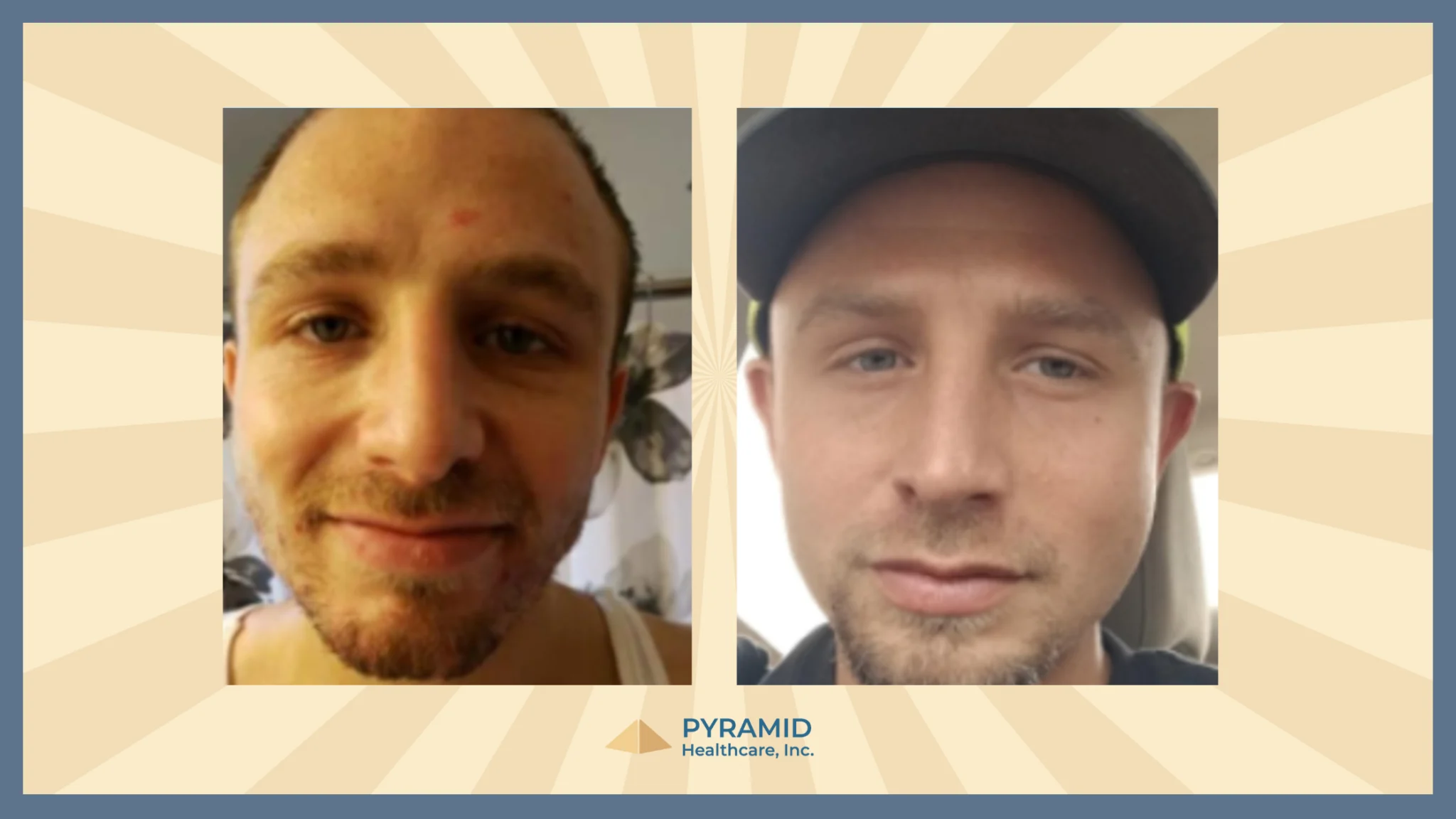 pyramid banner of a patient who was in the program and who is still sober